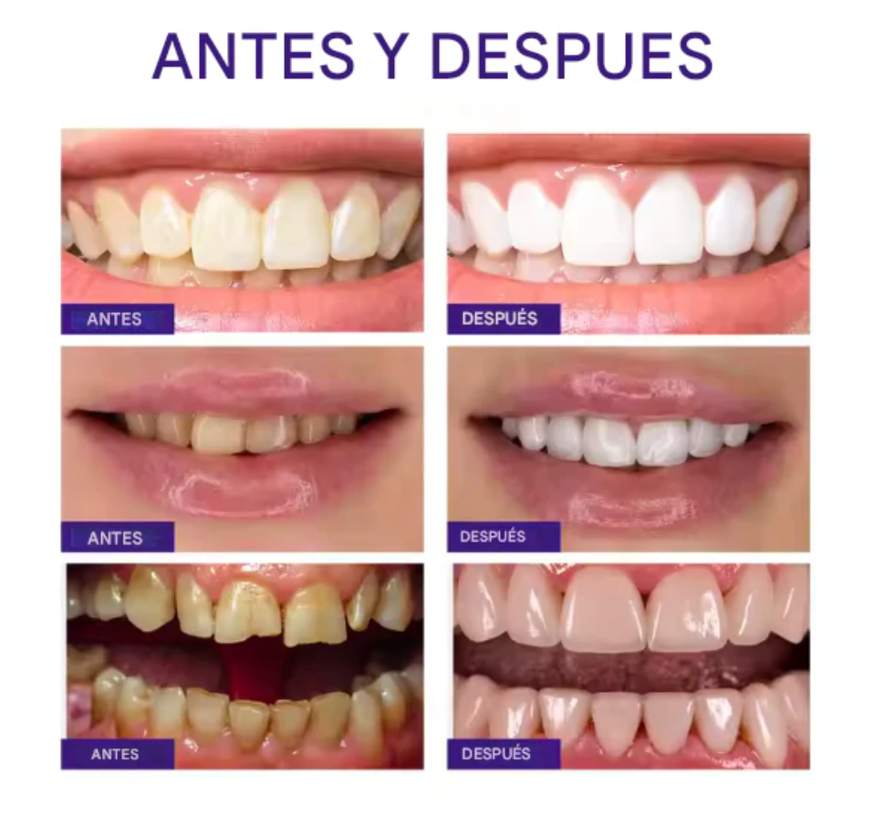 Blanqueador Dental Morada v34